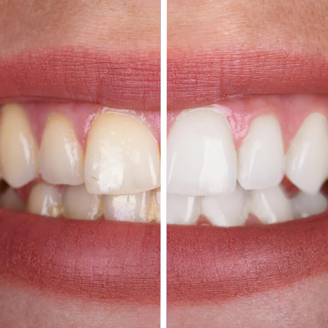 Natural Whitening Toothpaste Tablets