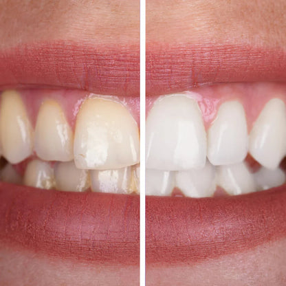 Natural Whitening Toothpaste Tablets